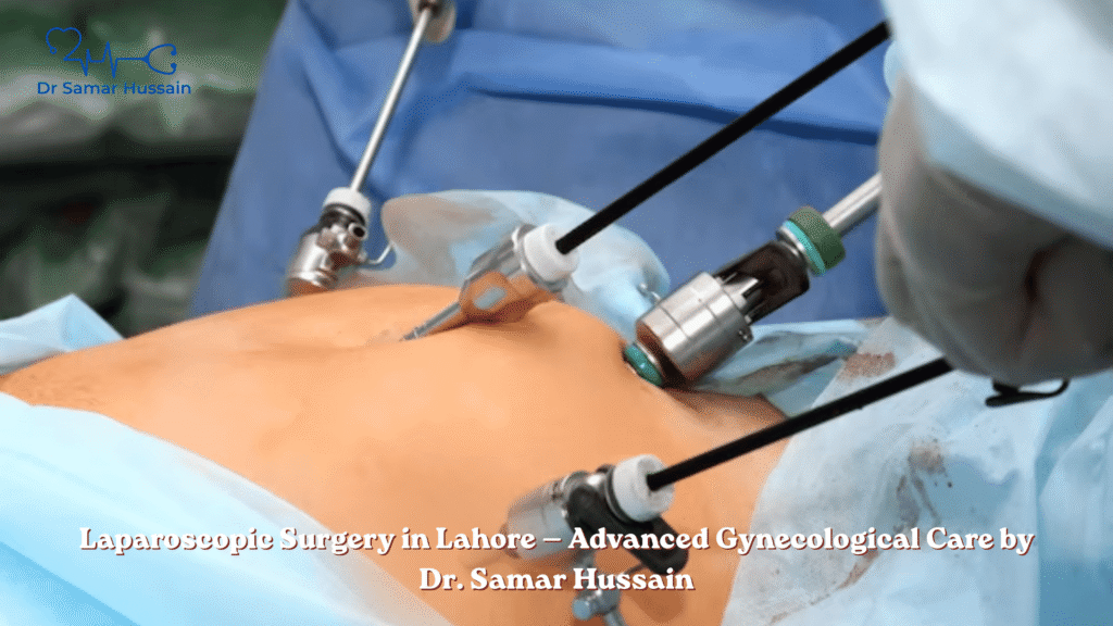 aparoscopic Surgery in Lahore